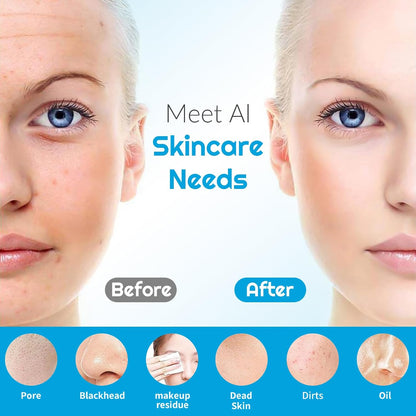 Landmore Silicone Face Scrubber, Waterproof Facial Cleansing Brush